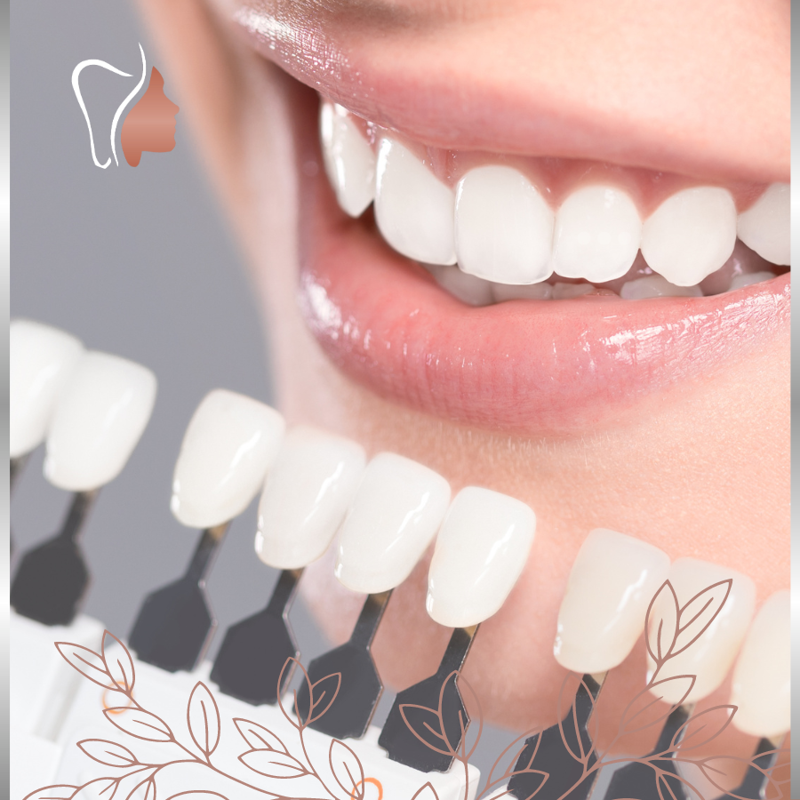 dente de contato.png